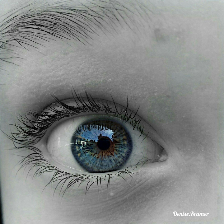 Eye
