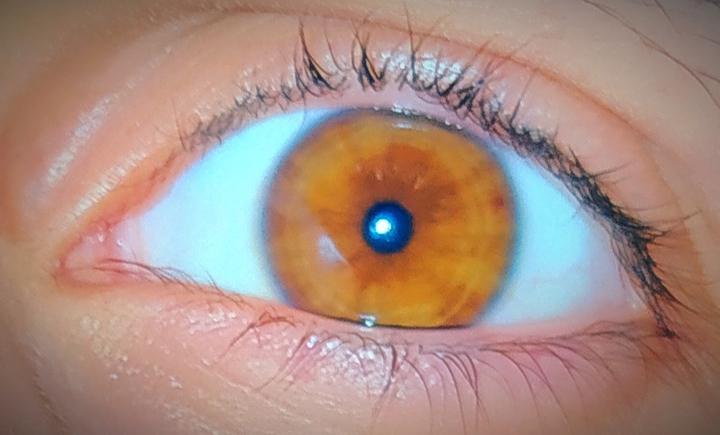 What you see?
