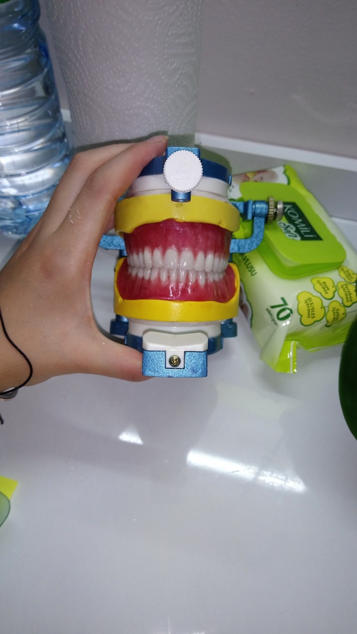 dental work