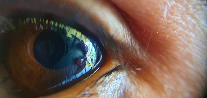 eye