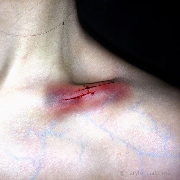 Collarbone