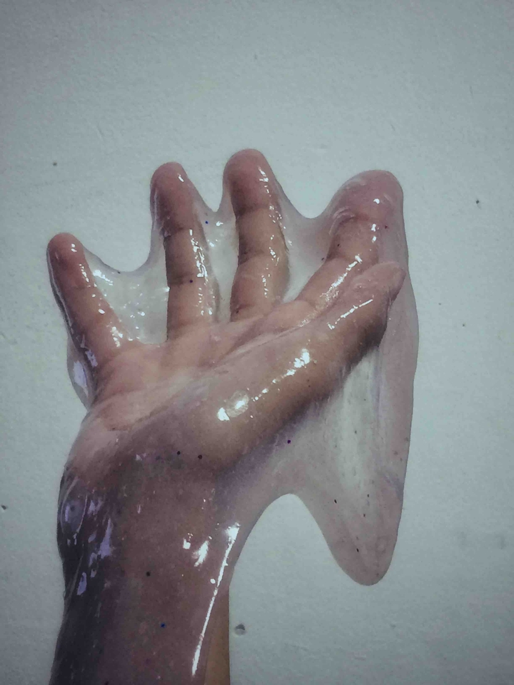 arm