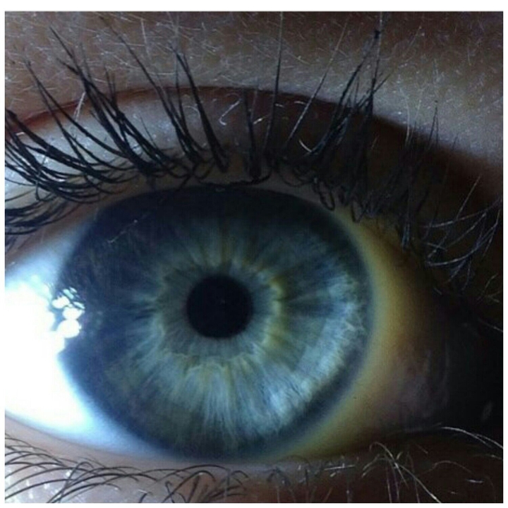 blue eye 