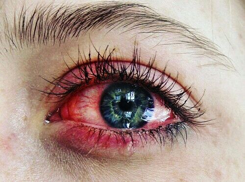 Pain full
