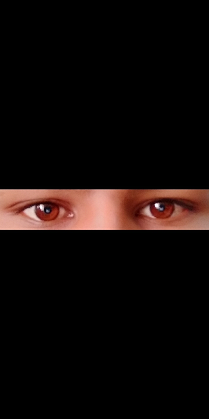 my eye