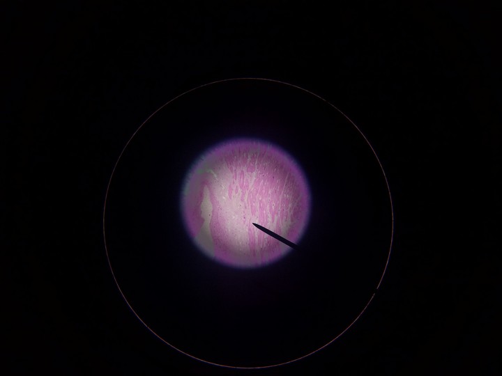 Microscopic Wonder
