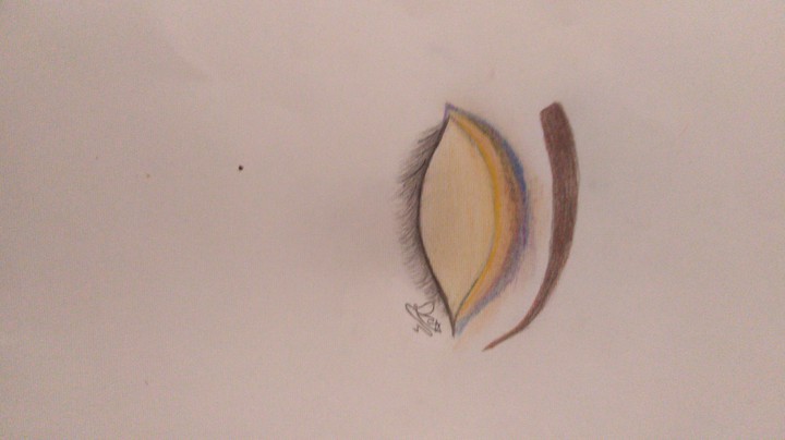 this is eye