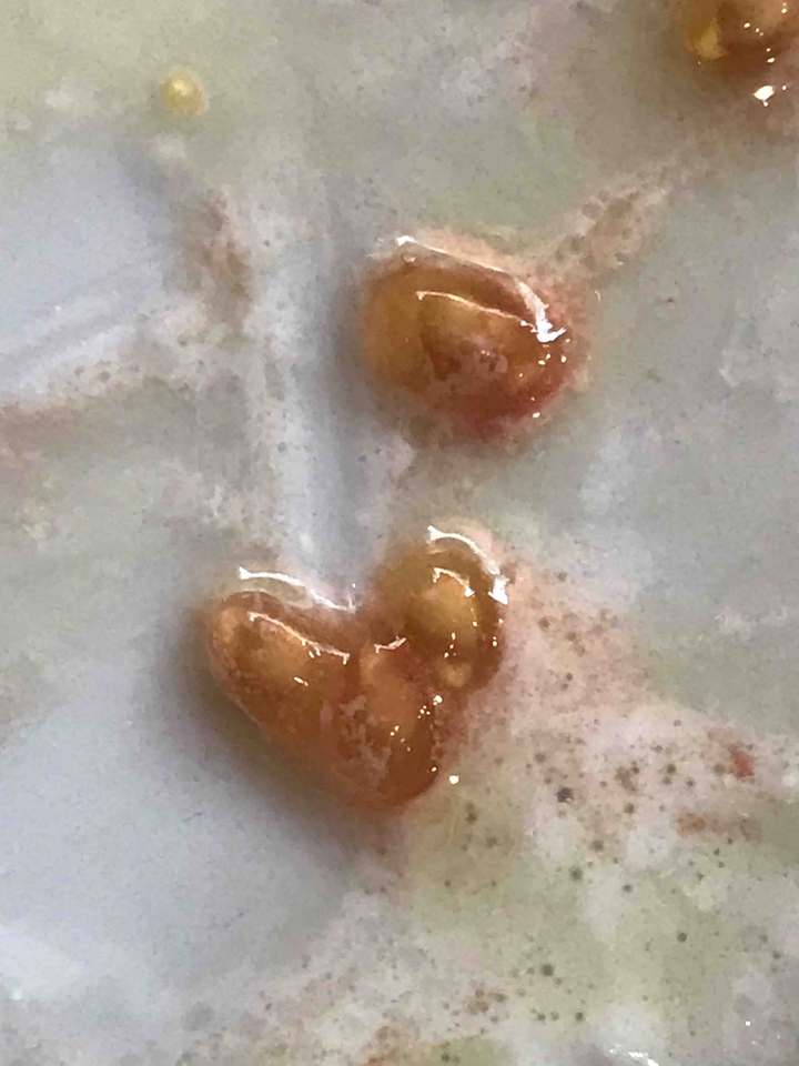 heart