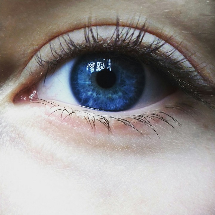 Eye