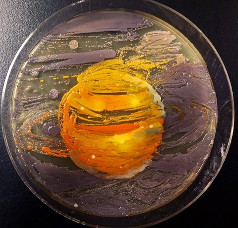 The agar planet?