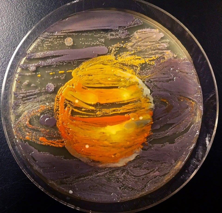 The agar planet?