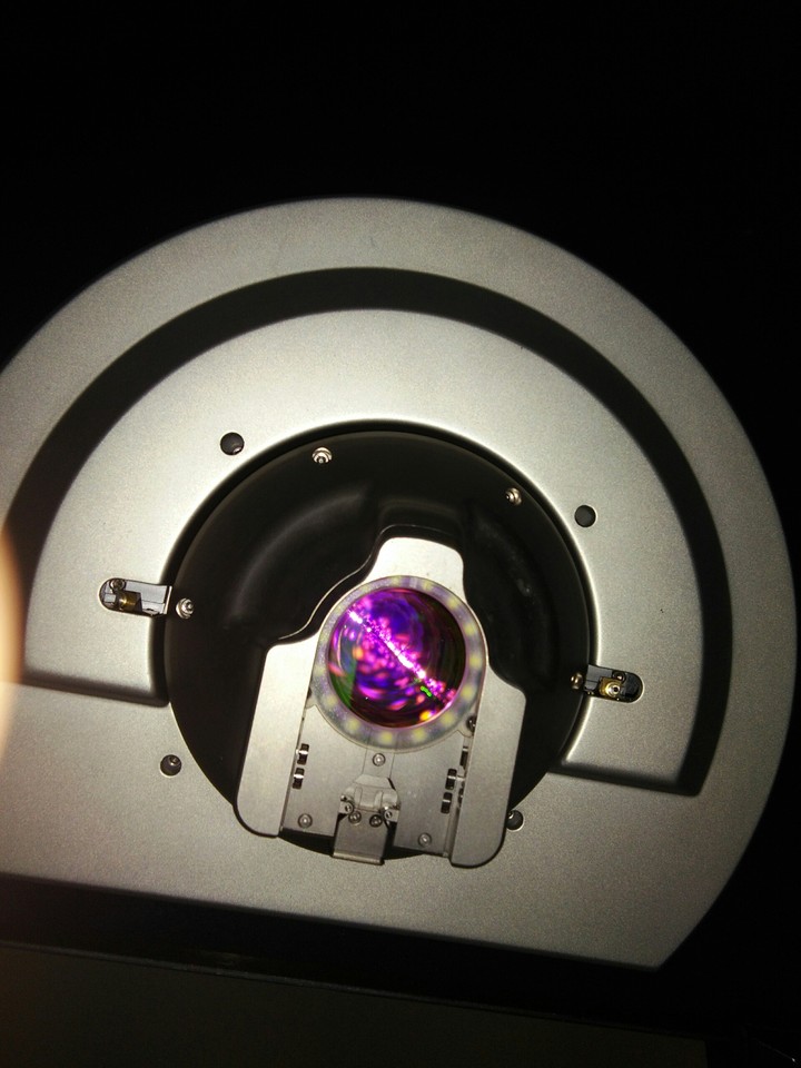 Lasik Surgery in Femto....