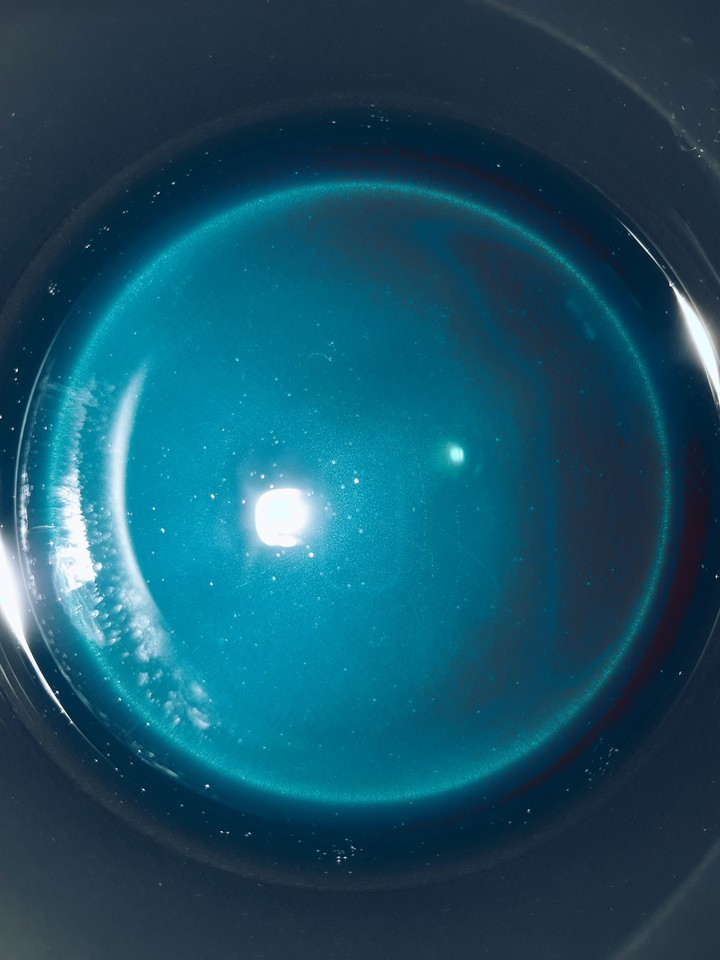 blue ster