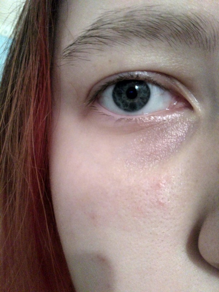 eye