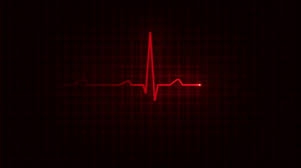 Heart Ecg