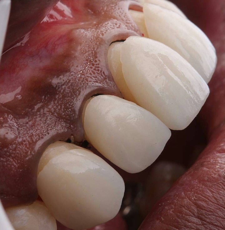 teeth