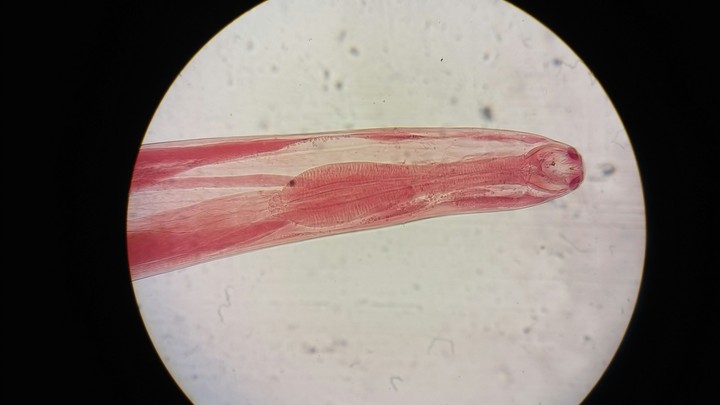 parasite