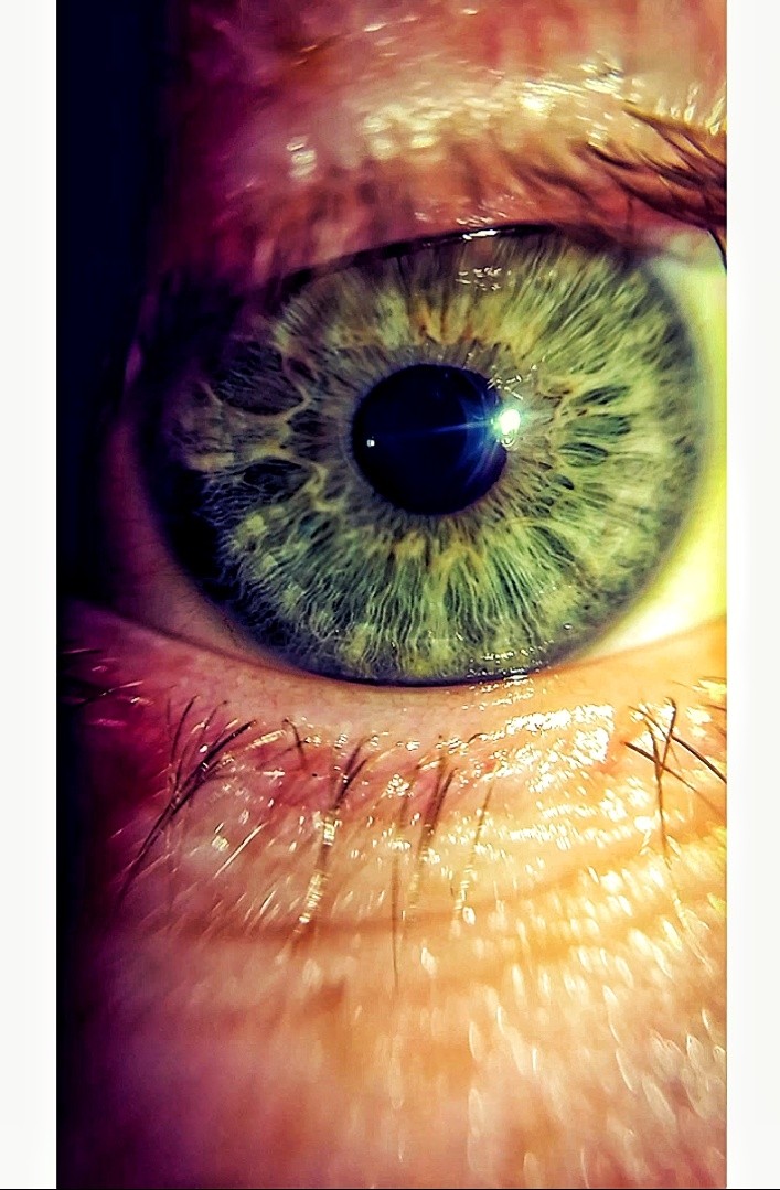 Eye