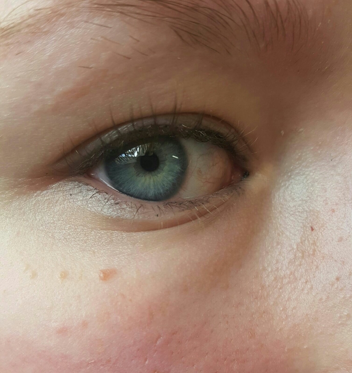 Blue eye
