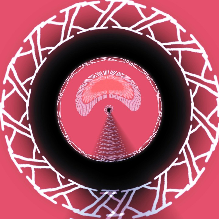Edit