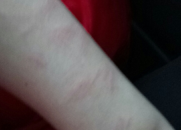 self harm