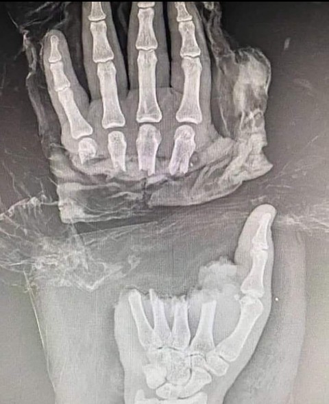 обои bone, Medical
