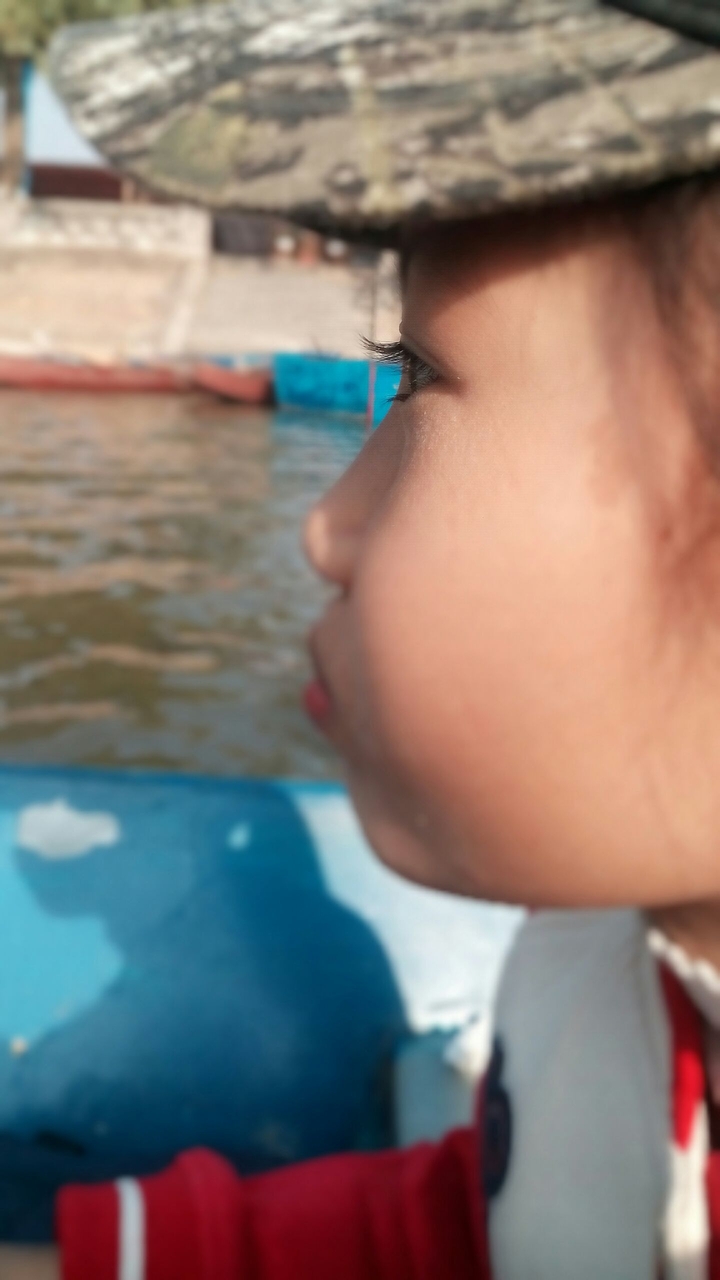 Eye