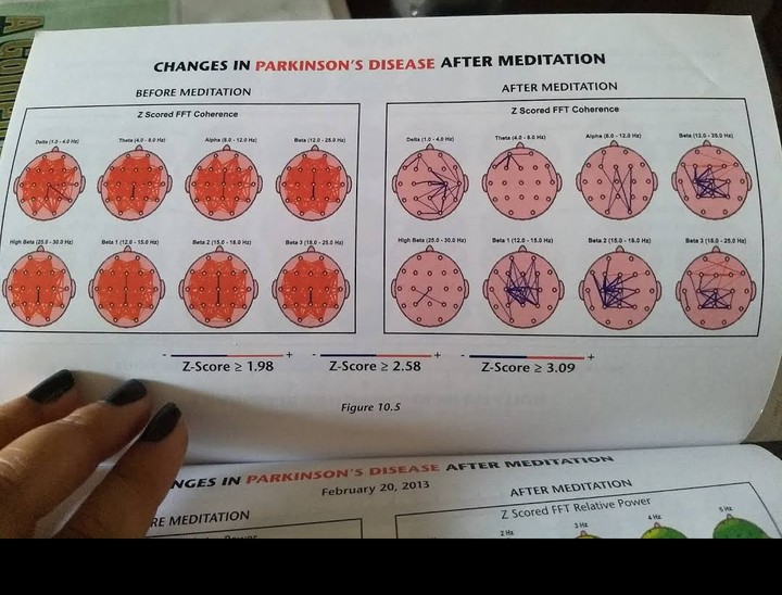 Brain After Meditation.