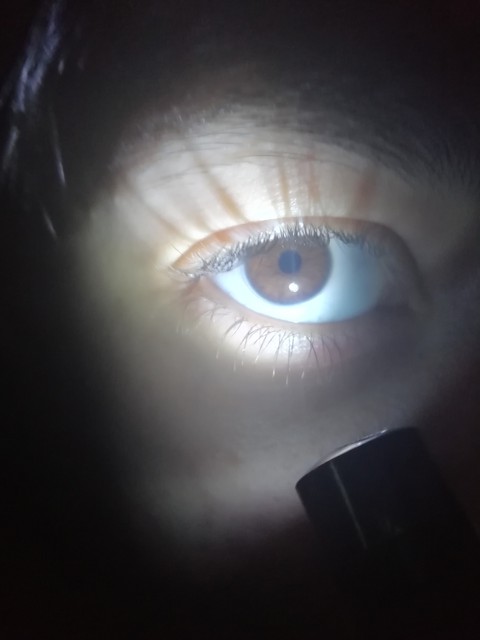eye