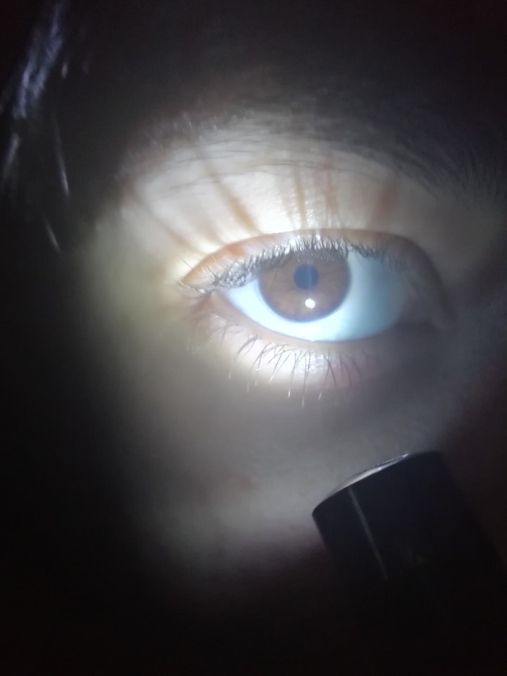 eye