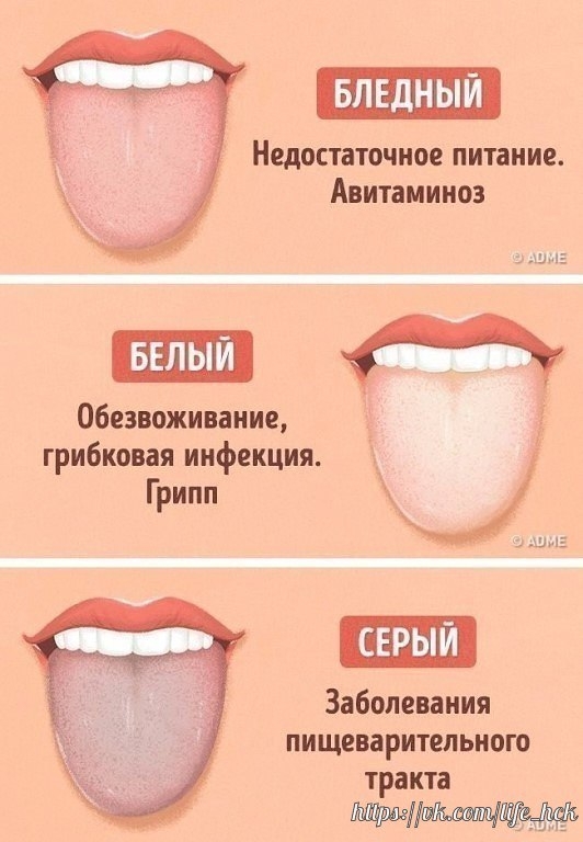 1)