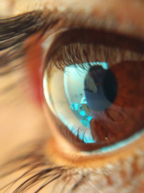 Eyes
