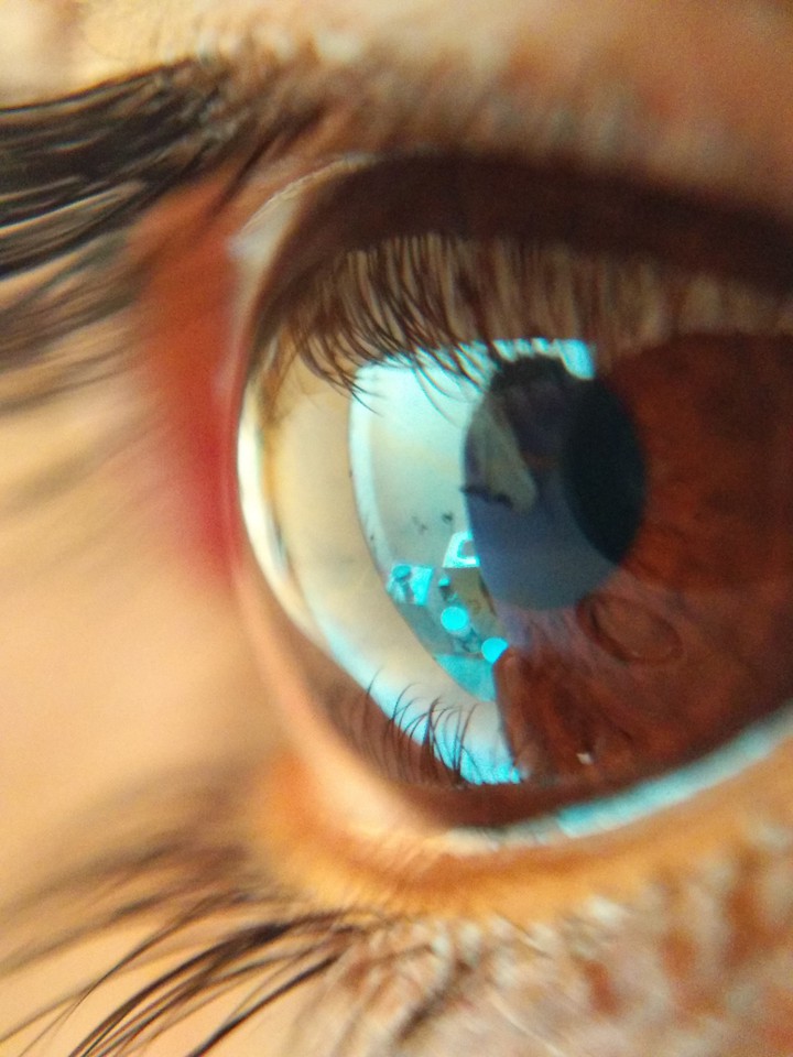 Eyes