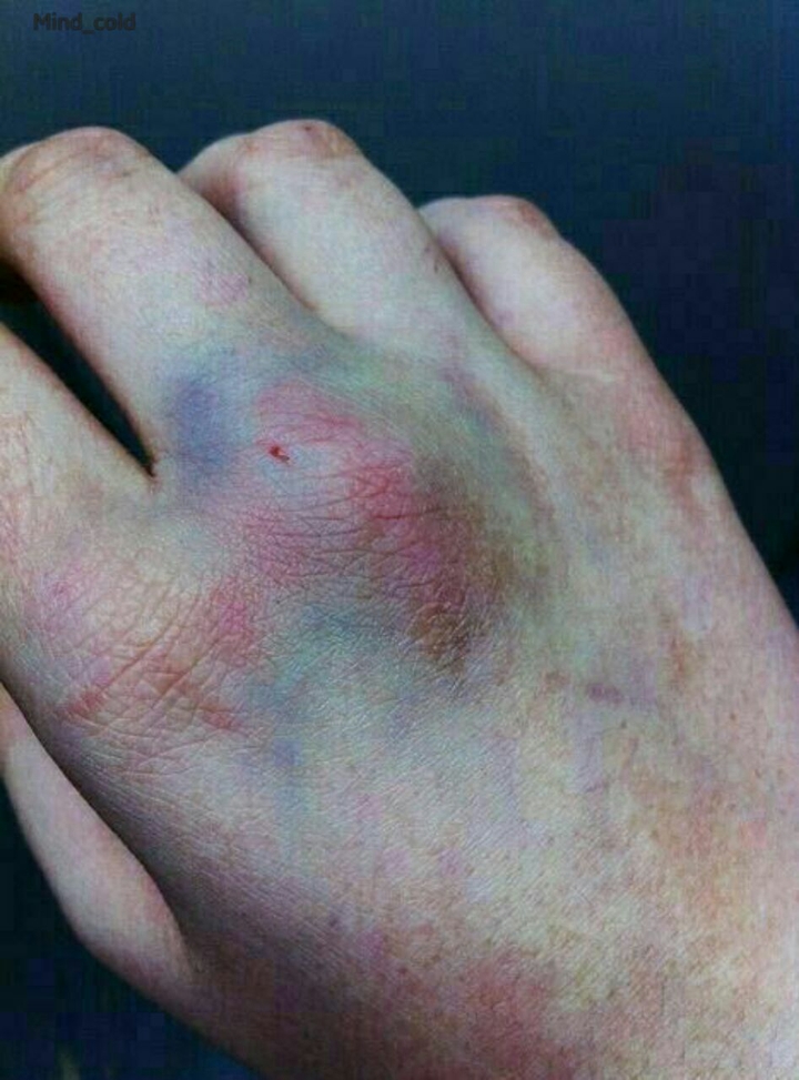 hand
