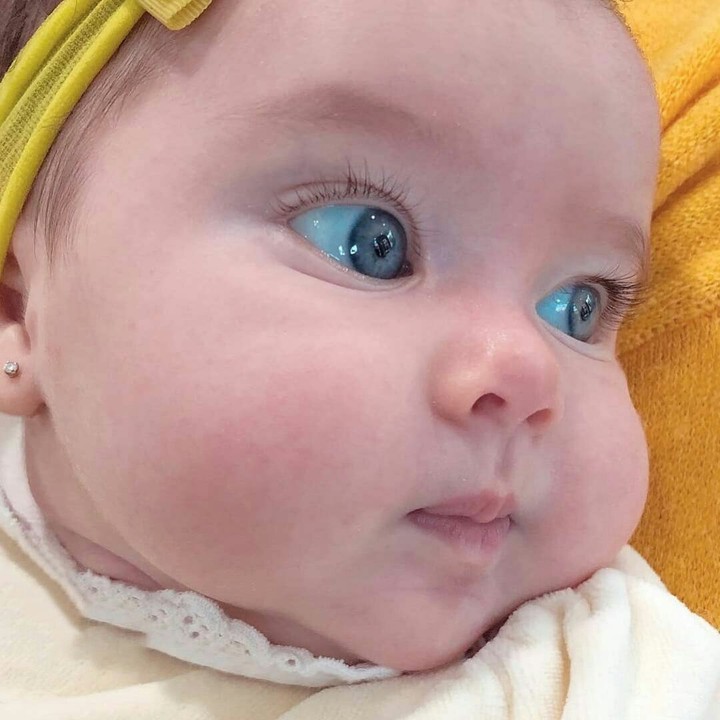 blue eyes