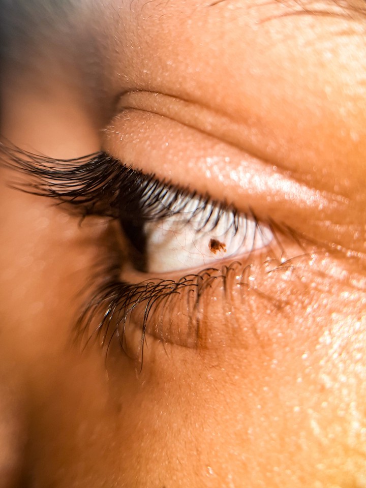 eye
