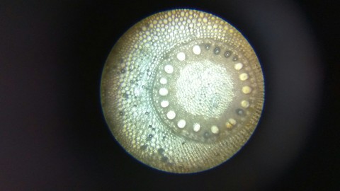 in the microscope....