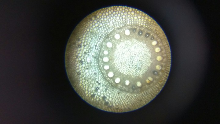 in the microscope....