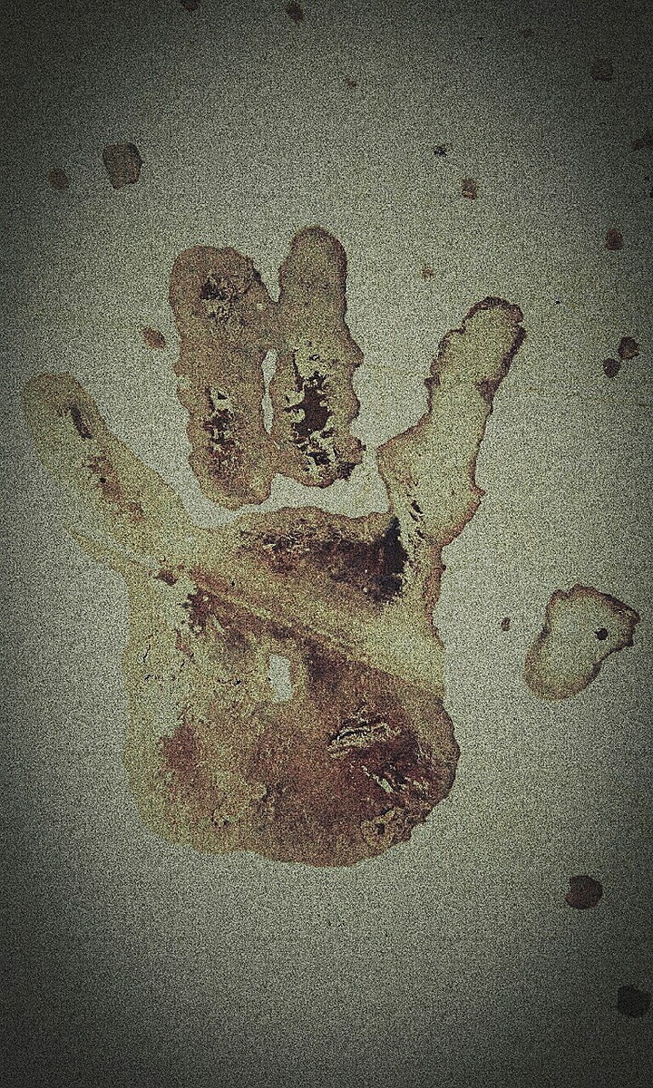 Z1