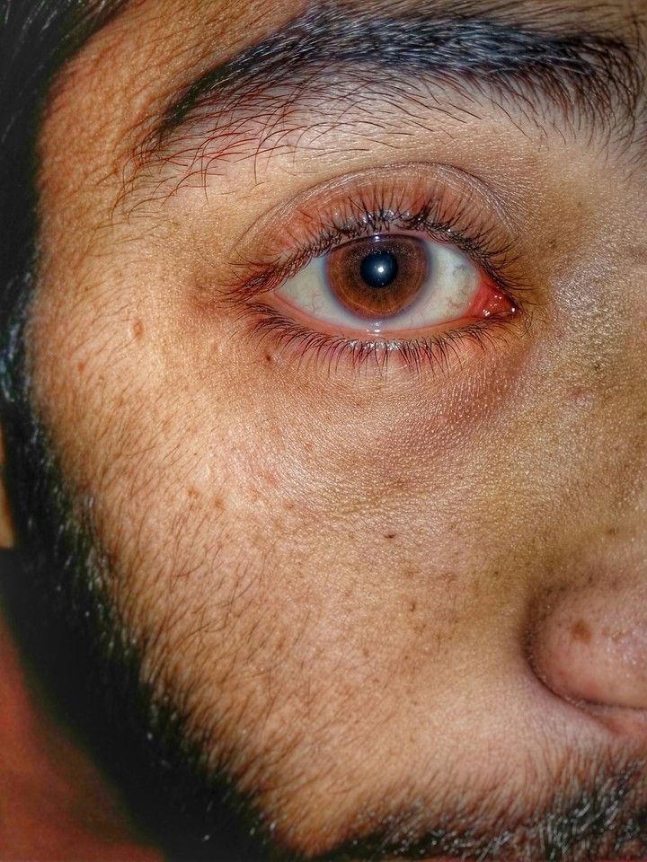 my eyes