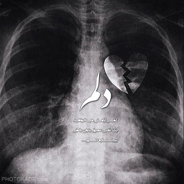 دلم